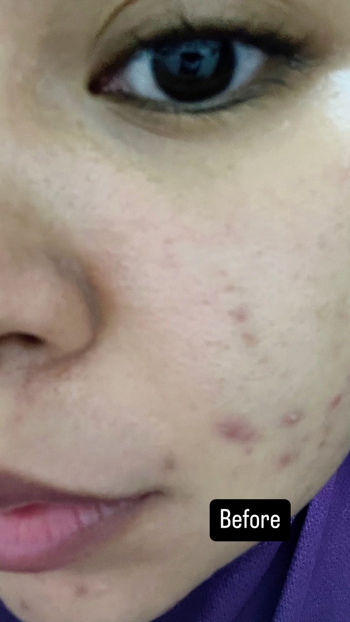 Collagen Mask customer review image 1