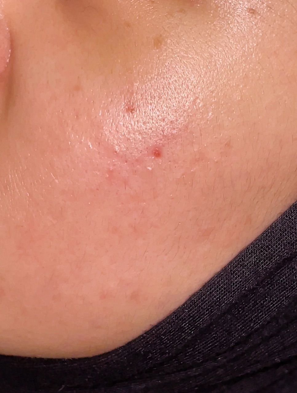Collagen Mask customer review image 4