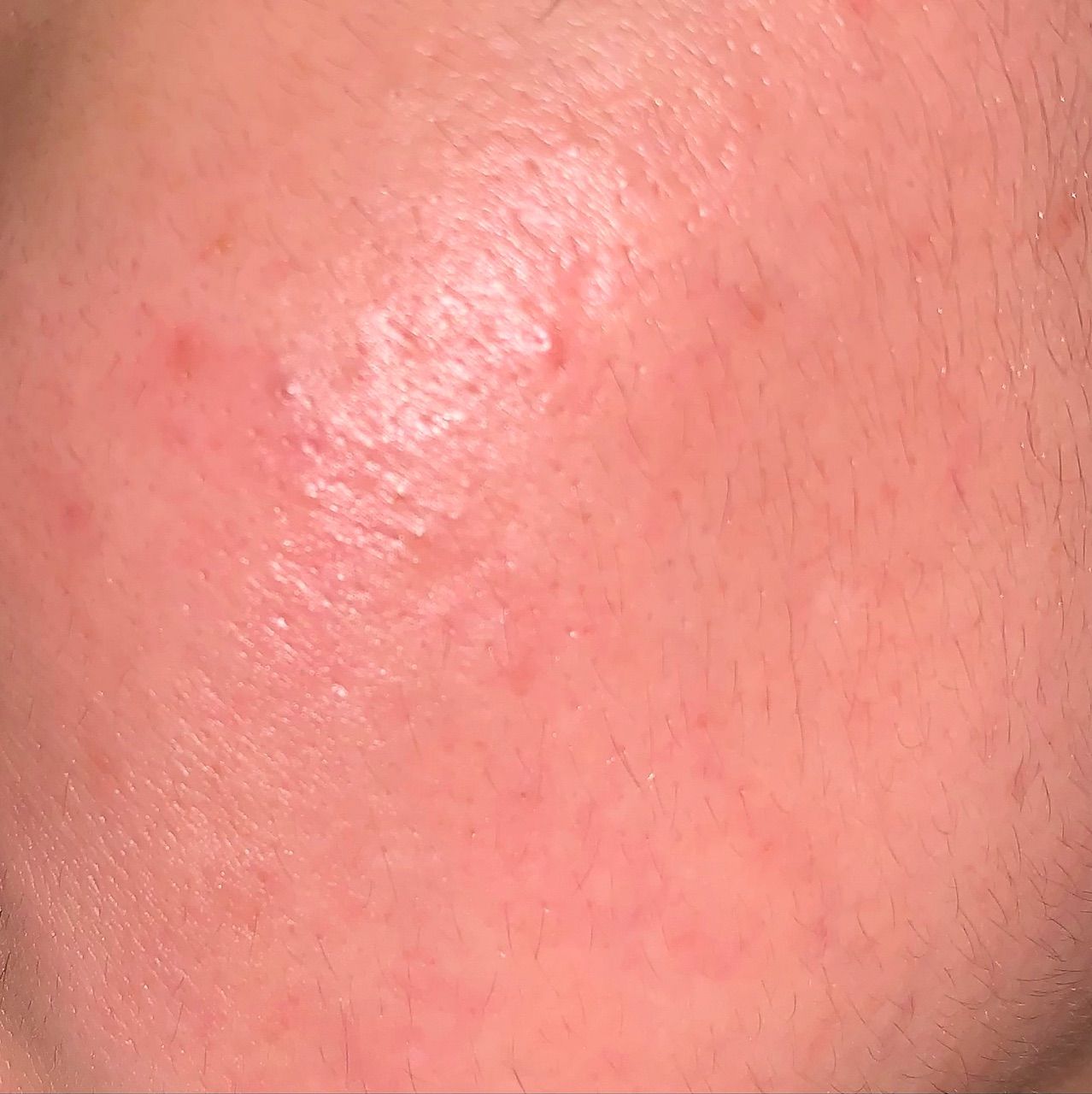 Collagen Mask customer review image 5