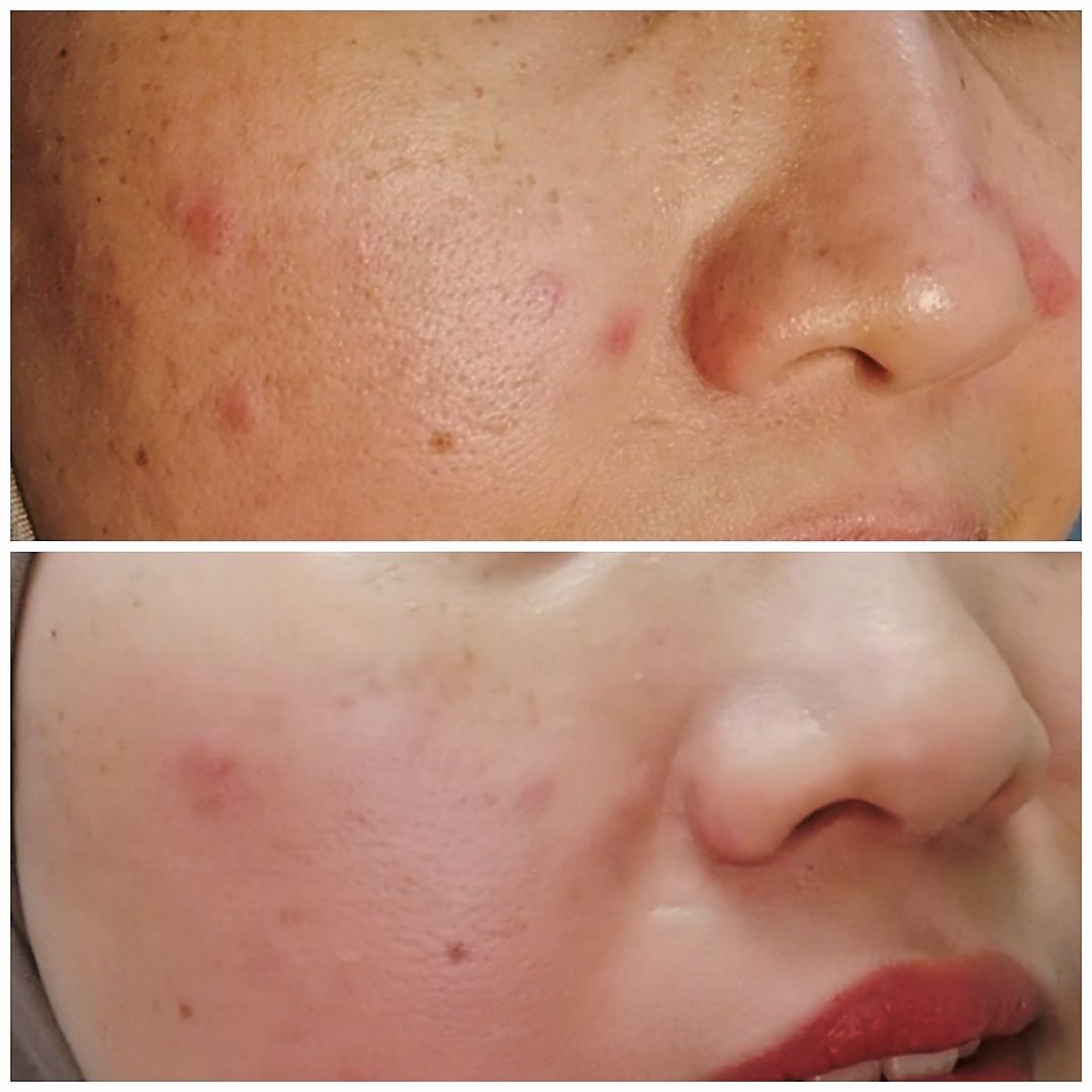 Night Cream customer review image 1