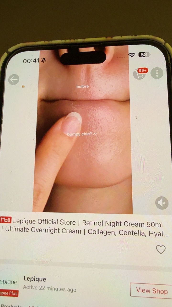 Eye Cream customer review image 1